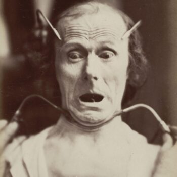 Guillaume-Benjamin-Armand Duchenne de Boulogne - Fright, from Mechanics of Human Physiognomy
